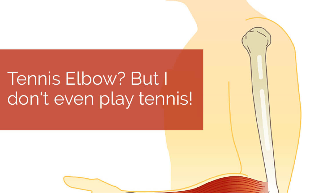 Tennis elbow isn’t just for athletes