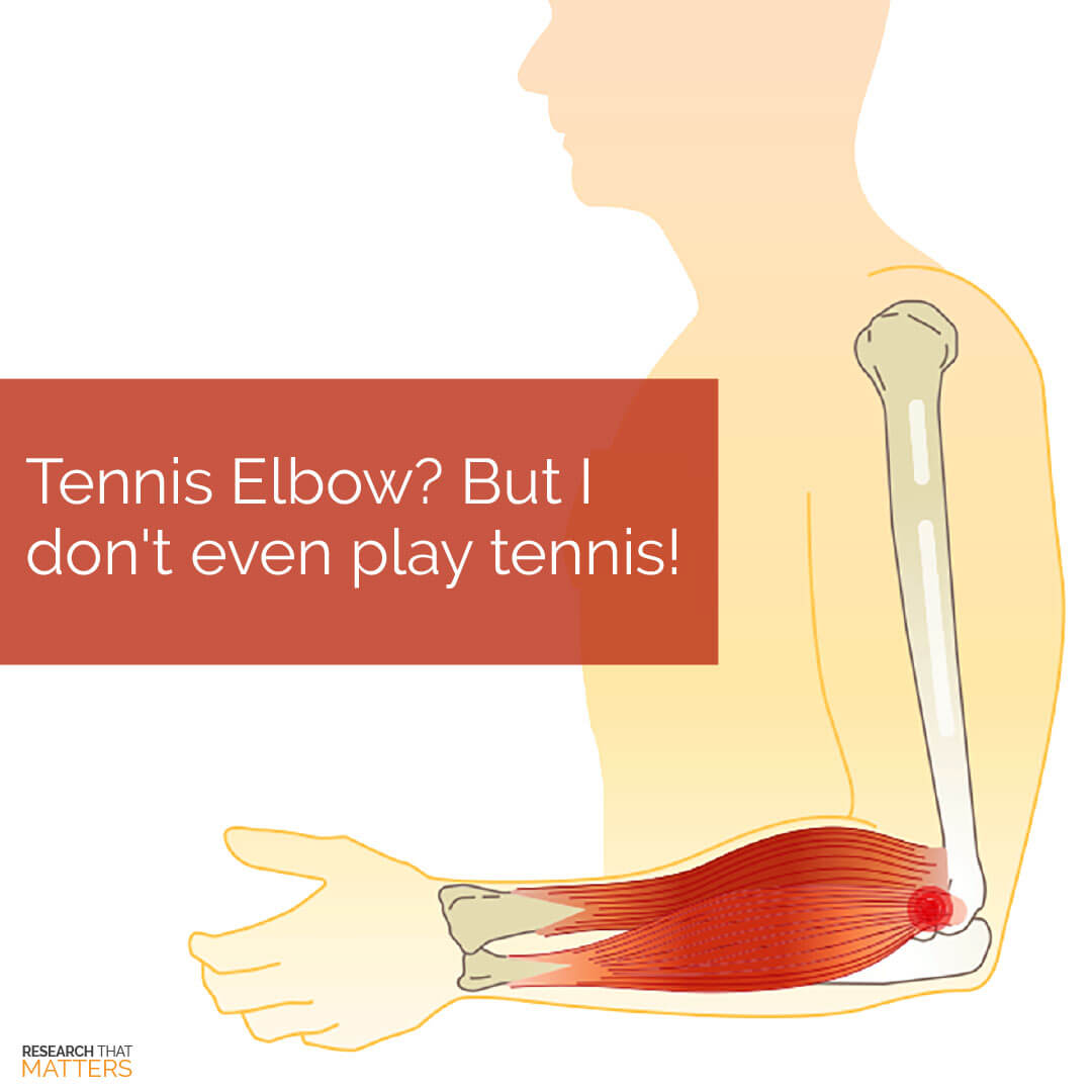 Tennis elbow isn't just for athletes | Etheredge Chiropractic & Weight Loss